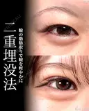 二重埋没＋ 7日後 サムネイル用