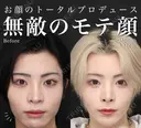 鼻＋小顔（複合施術） before画像 サムネイル用