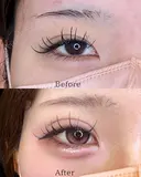 二重埋没 before画像 サムネイル用