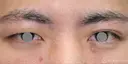 【20代男性・左右差を整える】二重埋没法（マイクロメソッド+α）（1ヶ月後） before画像 サムネイル用