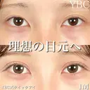 【💙YBC式クイックアイ💙】 after画像 サムネイル用