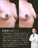 授乳後バスト革命✨｜ナチュラルバスト豊胸 after画像 サムネイル用