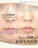 人中短縮 after画像 サムネイル用