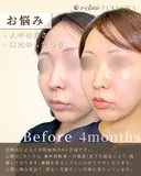 人中短縮 before画像 サムネイル用