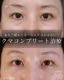 クマ取りでここまで変わる‼ after画像 サムネイル用
