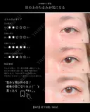 眉下切開/MD式 before画像 サムネイル用