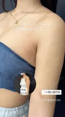 シークレット脂肪吸引二の腕 7日後 サムネイル用