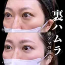 裏ハムラ before画像 サムネイル用