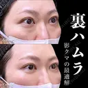 裏ハムラ 30日後 サムネイル用
