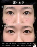 裏ハムラ before画像 サムネイル用
