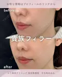 貴族フィラー after画像 サムネイル用