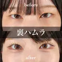 裏ハムラ 30日後 サムネイル用