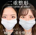 目頭切開 30日後 サムネイル用