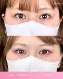 二重埋没 7日後 サムネイル用
