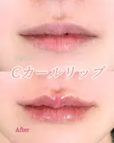 Cカールリップ before画像 サムネイル用