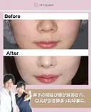 人中短縮 after画像 サムネイル用