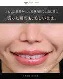 人中短縮（MIX切開） 180日後 サムネイル用