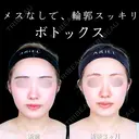 エラボトックス 90日後 サムネイル用