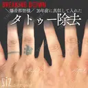 【タトゥー除去】爆音那智様　20年前に真似して入れた after画像 サムネイル用