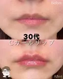 Cカールリップ after画像 サムネイル用