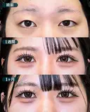 【二重埋没法】フォーエバークロス特殊5点留め after画像 サムネイル用