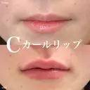 Ｃカールリップ（ボリフト） before画像 サムネイル用
