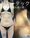 タミータック after画像 サムネイル用