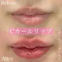 Cカールリップ after画像 サムネイル用