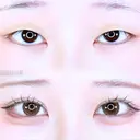 アリエルクイックループダブル二重埋没法 30日後 サムネイル用