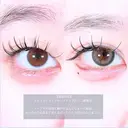 アリエルクイックループトリプル二重埋没法 before画像 サムネイル用