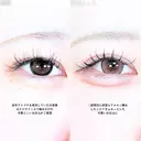 アリエルクイックループトリプル二重埋没法/涙袋ヒアルロン酸 before画像 サムネイル用