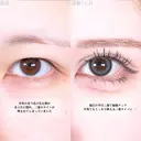 アリエルクイックループトリプル二重埋没法 before画像 サムネイル用