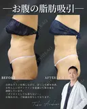 確実に体型チェンジ‼✨ before画像 サムネイル用