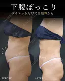 確実に体型チェンジ‼✨ after画像 サムネイル用