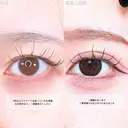 アリエルクイックループダブル二重埋没法 before画像 サムネイル用