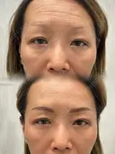 アートメイクで激変✨ after画像 サムネイル用