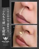 裏側人中短縮 180日後 サムネイル用