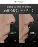 裏側人中短縮 before画像 サムネイル用