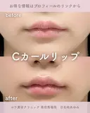 Cカールリップ after画像 サムネイル用
