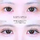 アリエルクイックループダブル二重埋没法 before画像 サムネイル用