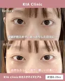 自然に可愛いく！目元に立体感をプラス！！ before画像 サムネイル用