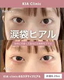 自然に可愛いく！目元に立体感をプラス！！ after画像 サムネイル用