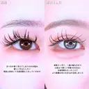 アリエルクイックループトリプル二重埋没法/目頭切開 before画像 サムネイル用