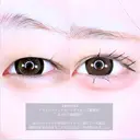 アリエルクイックループダブル二重埋没法/瞼の脂肪取り before画像 サムネイル用