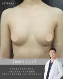 理想のバスト作れます!!🩷 before画像 サムネイル用
