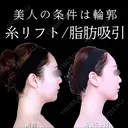 糸リフト/頬・アゴ下脂肪吸引/アゴヒアルロン酸/アゴボトックス 180日後 サムネイル用