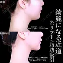 糸リフト/頬・アゴ下脂肪吸引/アゴヒアルロン酸/アゴボトックス before画像 サムネイル用
