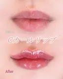 Cカールリップ 0日後 サムネイル用