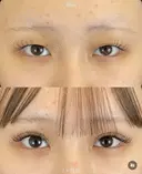 二重埋没(ルラコスメダブル） 30日後 サムネイル用