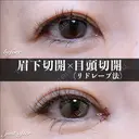 目頭切開(リドレープ法)･眉下切開 before画像 サムネイル用